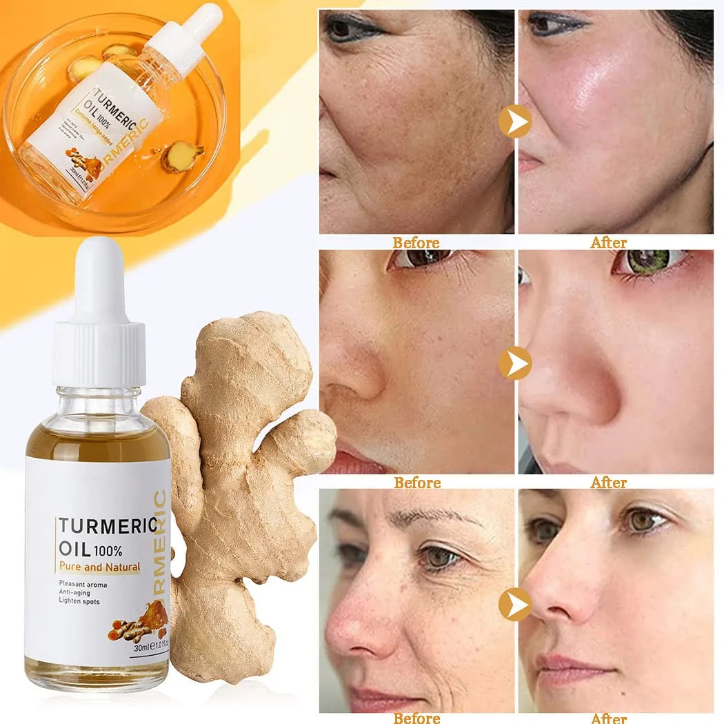 Go Radiant! Turmeric Face Oil remove Dark Spots All Skin types (Women / Men)